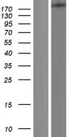 Dicer (DICER1) Human Over-expression Lysate