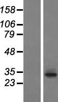 TAS2R60 Human Over-expression Lysate