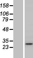 Syntaxin 12 (STX12) Human Over-expression Lysate