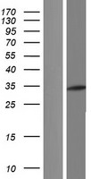ADA2 Human Over-expression Lysate