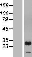 RAB7B Human Over-expression Lysate