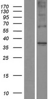 TAS2R44 (TAS2R31) Human Over-expression Lysate