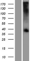 TAS2R39 Human Over-expression Lysate