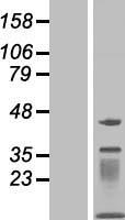 MOCS2 Human Over-expression Lysate