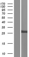 SULT1A1 Human Over-expression Lysate