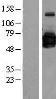 GOLPH2 (GOLM1) Human Over-expression Lysate