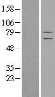 CSRP2BP (KAT14) Human Over-expression Lysate
