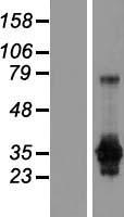 GAS2 Human Over-expression Lysate