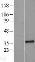 CSPS (SULT1A3) Human Over-expression Lysate
