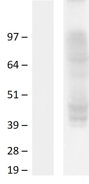 HCAR2 Human Over-expression Lysate