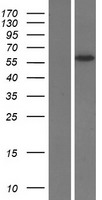 SLC13A5 Human Over-expression Lysate