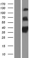 TAS1R1 Human Over-expression Lysate