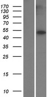 TUBB8 Human Over-expression Lysate