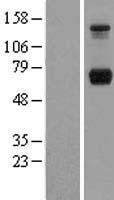 PPM1G Human Over-expression Lysate