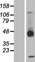 PPM1B Human Over-expression Lysate