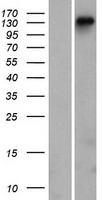 DGKH Human Over-expression Lysate