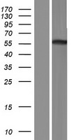 TRIM50 Human Over-expression Lysate