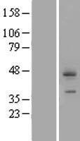 CDCP1 Human Over-expression Lysate