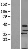 MOGAT3 Human Over-expression Lysate