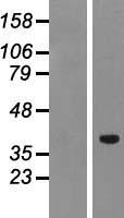 PTF1A Human Over-expression Lysate