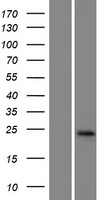 GGTLC1 Human Over-expression Lysate
