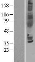 CCR3 Human Over-expression Lysate