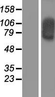 SOX30 Human Over-expression Lysate