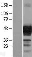 Doublecortin (DCX) Human Over-expression Lysate