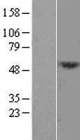 DCAF12L1 Human Over-expression Lysate
