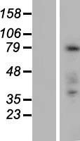 FAM83C Human Over-expression Lysate