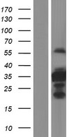 C1orf110 (CCDC190) Human Over-expression Lysate