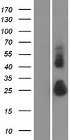 TMEM52 Human Over-expression Lysate