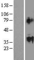 ACTL9 Human Over-expression Lysate