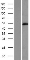TMEM102 Human Over-expression Lysate