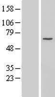 CCDC60 Human Over-expression Lysate