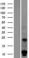 DUSP15 Human Over-expression Lysate