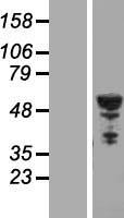 TUBB2B Human Over-expression Lysate