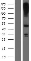 LASS3 (CERS3) Human Over-expression Lysate