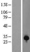 RNF166 Human Over-expression Lysate