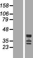 C19orf47 Human Over-expression Lysate
