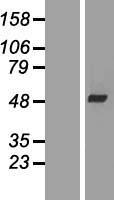 WDR69 (DAW1) Human Over-expression Lysate