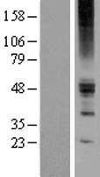 LGICZ1 (ZACN) Human Over-expression Lysate
