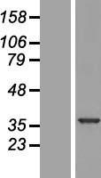 U1SNRNPBP (SNRNP35) Human Over-expression Lysate