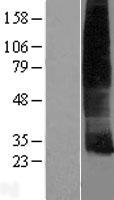 Cklfsf8 (CMTM8) Human Over-expression Lysate