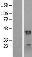 RNF113B Human Over-expression Lysate