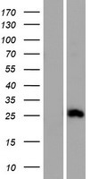CMTM4 Human Over-expression Lysate