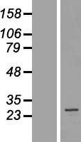 AKAP14 Human Over-expression Lysate
