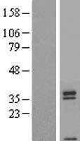 TAS2R42 Human Over-expression Lysate
