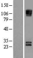 CD56 (NCAM1) Human Over-expression Lysate