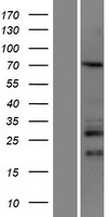 CCDC67 (DEUP1) Human Over-expression Lysate
